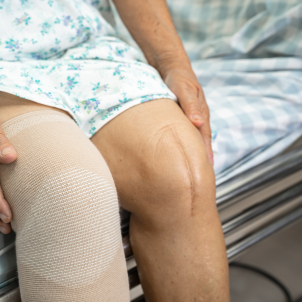 Knee replacement recovery timeline and exercises