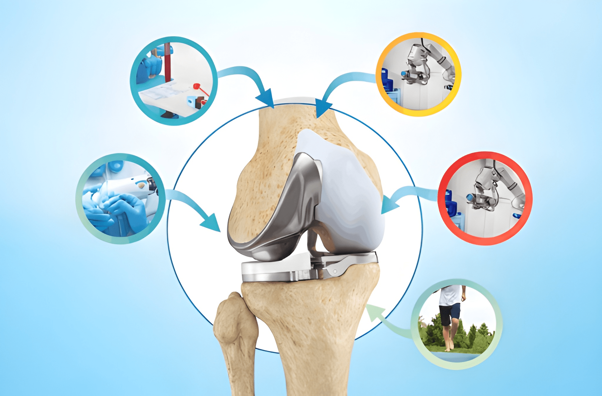 Robotic Knee Replacement Benefits