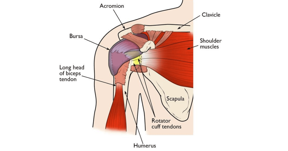 Rotator Cuff Tear