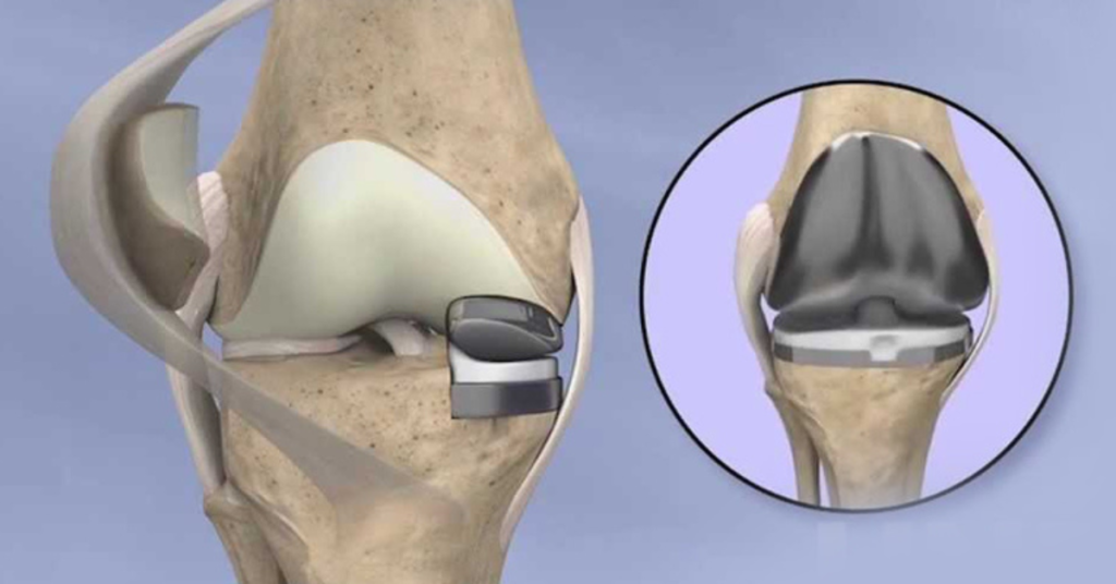 Best orthopaedic doctor